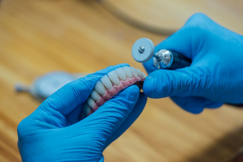 Prefeitura de Campo Mourão realiza novo mutirão para confecção de próteses dentárias
