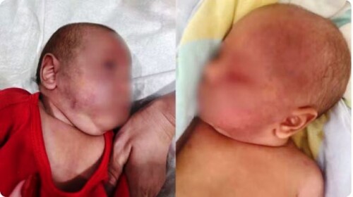Pai é condenado a 22 anos de prisão por espancar filho de três meses de idade no Paraná