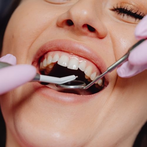 Campo Mourão realiza campanha Novembro Vermelho com ações de prevenção ao câncer bucal