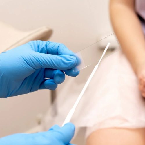 Campo Mourão realiza campanha de exames preventivos para mulheres neste sábado (18)