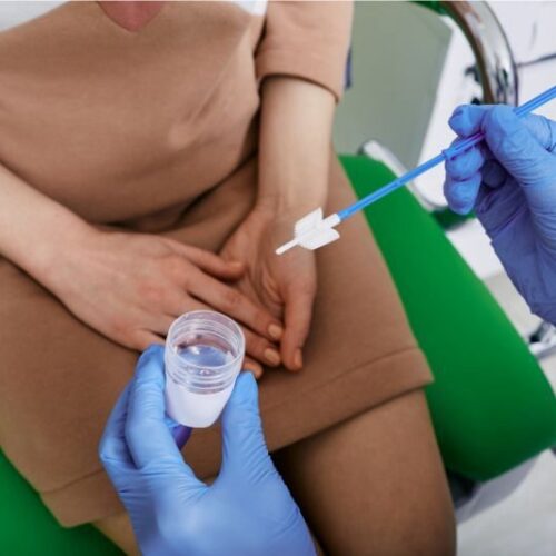 Secretaria de Saúde de Campo Mourão promove campanha de exames preventivos para mulheres com horário estendido nas UBSs