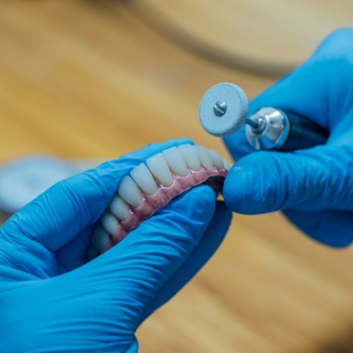 Prefeitura de Campo Mourão realiza novo mutirão para confecção de próteses dentárias